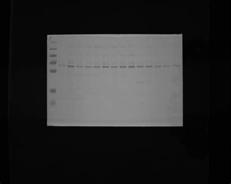 ADAM10 antibody (25900-1-AP) | Proteintech
