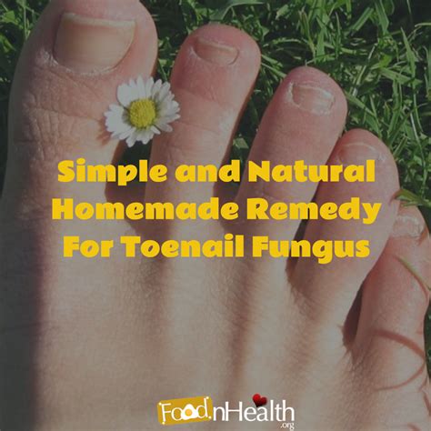 Toenail Fungus Treatment Diy at Clark Burdine blog