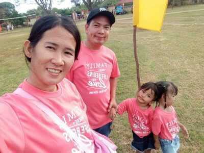 Saudi Arabia separates Filipino twins in one of world's most complex ...