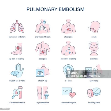 Pulmonary Embolism Symptoms Diagnostic And Treatment Vector Icons ...