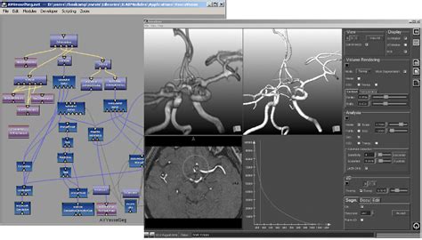 Image result for MeVisLab Connectors Triangle