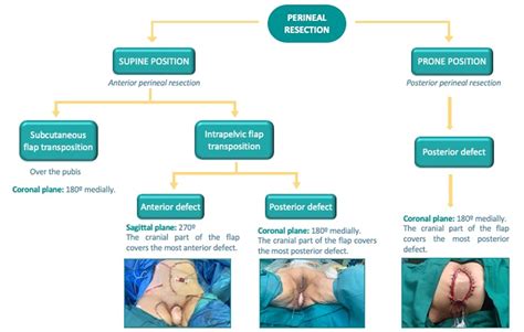 Image result for Modular Org Structure