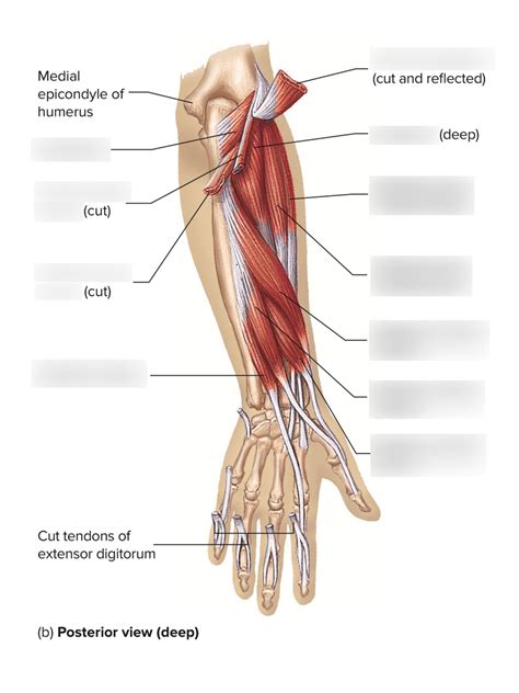 Image result for Contralateral Forearm
