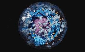 Lyse & Proteinextraktion