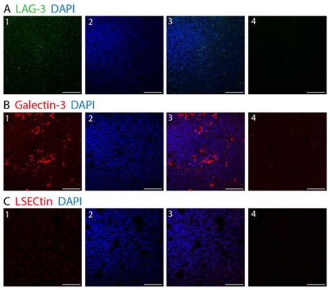 Characterization and Quantitation of the Tumor Microenvironment of ...