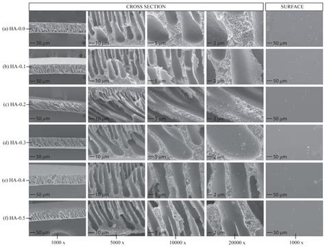 Study of Polysulfone-Impregnated Hydroxyapatite for Ultrafiltration in ...