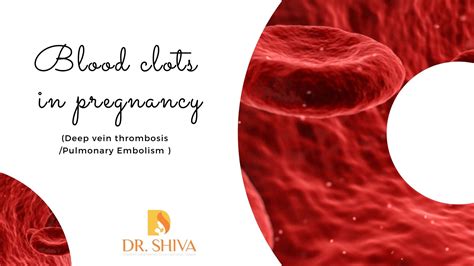 Blood Clots During Pregnancy (DVT/PE) | Blood Clots While Pregnant