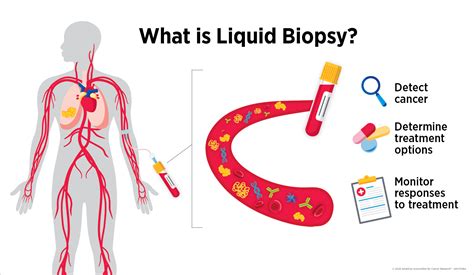 What Is Liquid Biopsy? | Blog | AACR