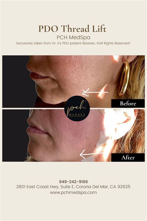 Image result for Cheek Threads