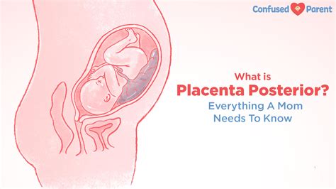 What Is Placenta Posterior – Everything A Mom Needs To Know
