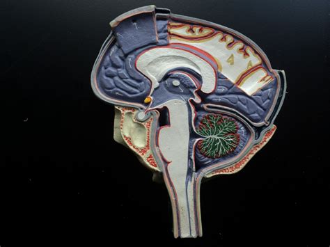 CSF Flow Chart 的图像结果