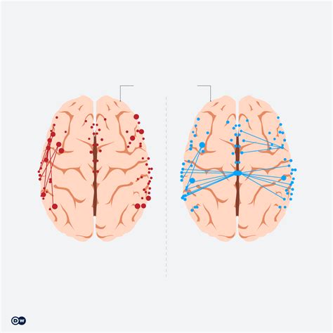 Language Brain 的图像结果