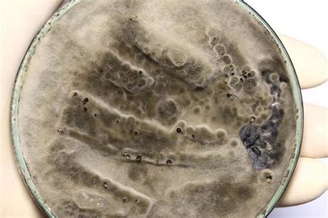 Image result for Dead Pathogen