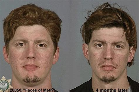 The faces of meth reversed - Mirror Online