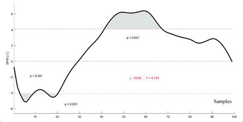 Statistical Parametric Mapping 的图像结果