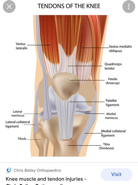 Pin by Lillie whitehead on medical | Knee ligaments, Knee tendon pain, Ligaments and tendons