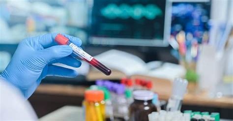 IISc Develops Artificial Enzyme To Block HIV Reactivation In AIDS Patients