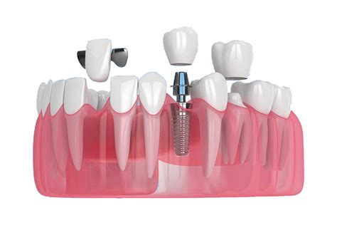 Studio Dental - Best Dental Hospital in Hyderabad - Dental Clinic ...