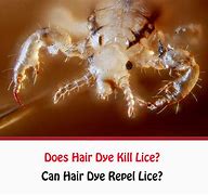 Image result for Kill Lice in 10 Seconds