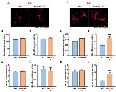 Alterations in Dendritic Spine Maturation and Neurite Development ...