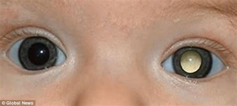 Olhos brilhando diferente | BabyCenter