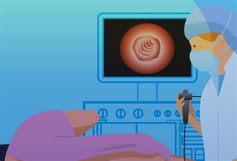 Getting a Colonoscopy 的图像结果