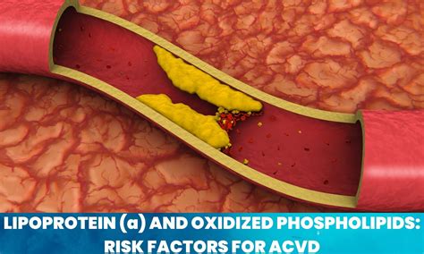 Lipoprotein(a) and Oxidized Phospholipids Independent Risk Factors for ...