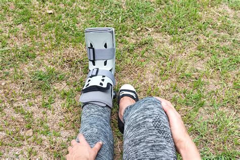 Bunion Surgery Recovery: What To Expect and How To Prepare — Snug Safety