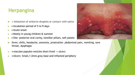 Ulcerative , vascular , bollous lesions | PPTX