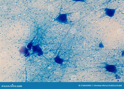 Motor Neurons Under the Microscope Stock Image - Image of care ...