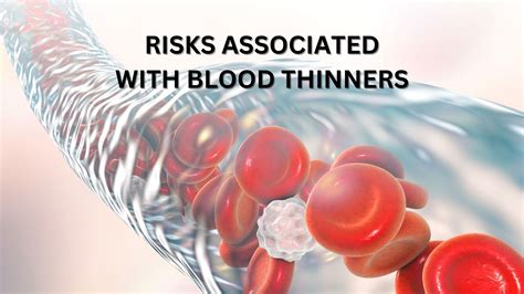 Blood Thinners and the Risks Associated with Taking Them