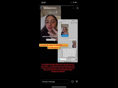 Alix : Son nom utilisé pour de la chirurgie esthétique, elle pousse un ...