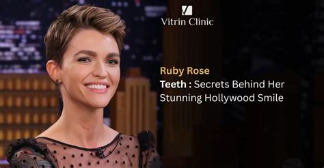 Ruby Rose Teeth: Smile Aesthetic Guide - Vitrin Clinic