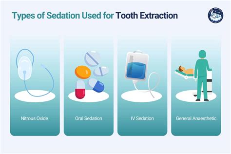 Sleep Dentistry for Tooth Extraction - Sleep Dentistry