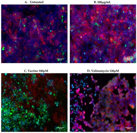 Comparing the Effects of Intracellular and Extracellular Magnetic ...