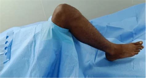 Surgical Drapes - Poly Drape or Plain Sheet ( PS 100 ) Manufacturer ...