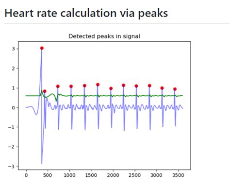 Image result for R-R Interval Calculation for ECG Code in Python