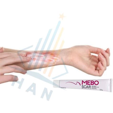 Buy 3 PCS MEBO Scar Cream Original Mebo Scar Ointment Cream (3 Pcs - 30 ...