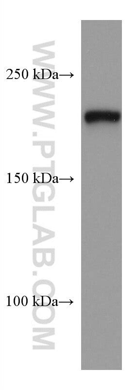 PHLPP1 antibody (67640-1-PBS) | Proteintech
