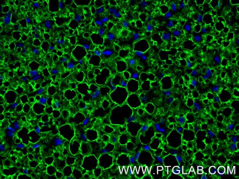 HSL antibody (84540-1-RR) | Proteintech