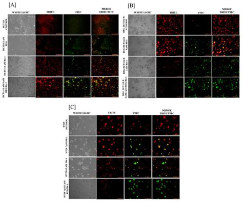 Regorafenib and Ruthenium Complex Combination Inhibit Cancer Cell ...