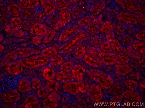 SSTR5 antibody (CL594-66772) | Proteintech