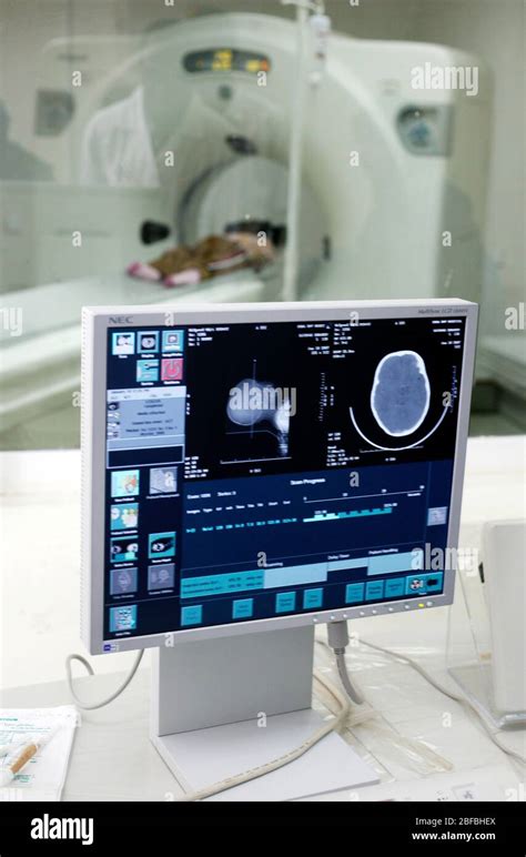 Image result for CT Scanner Control Panel