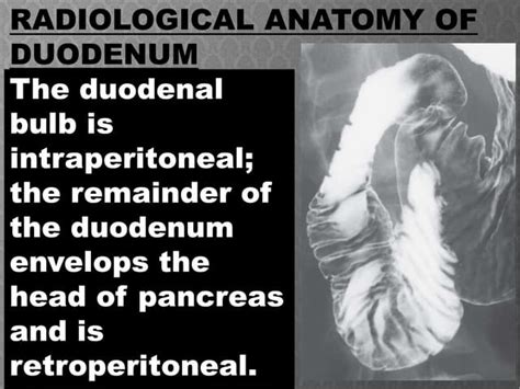 Duodenum Definition 的图像结果
