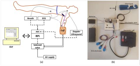 A Portable Device for the Measurement of Venous Pulse Wave Velocity