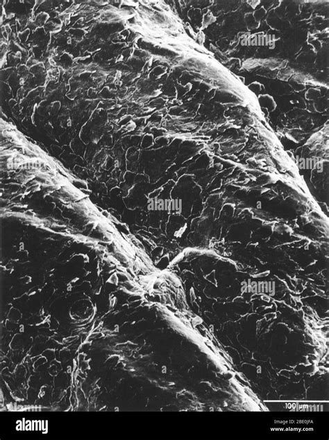 Scanning Electron Micrograph 的图像结果