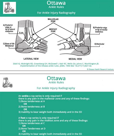Ankle Sprain - Foot & Ankle - Orthobullets