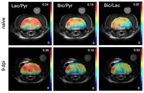 Metabolic Imaging of Hyperpolarized [1-13C]Pyruvate in a Ferret Model ...