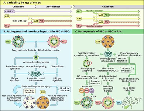 Immunopathogenesis of Primary Biliary Cholangitis, Primary Sclerosing ...