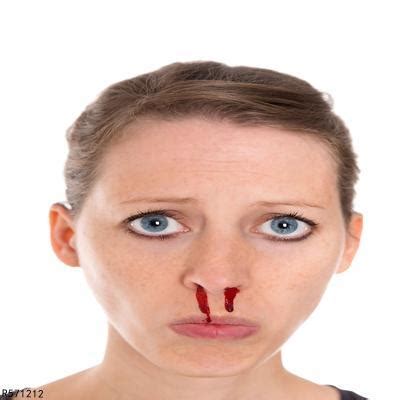 突然流鼻血怎么办？原因13种，鼻子经常流血不止该这样处理！_症状